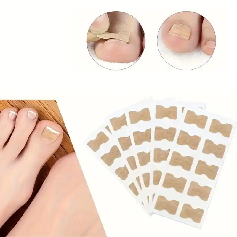 100pcs Ingrown Toenail Corrector Pads Gluefree Nail Patches For Correction