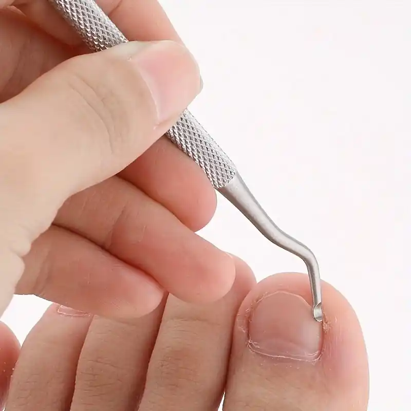 Professional Ingrown Toenail Correction Tool Pedicure And Nail Care Kit